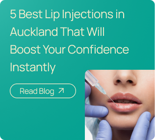 Best-Lip-Injections-in-Auckland